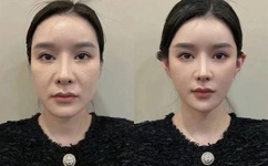 69成线在人线免费视频